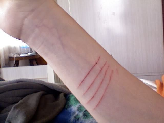 Pain
